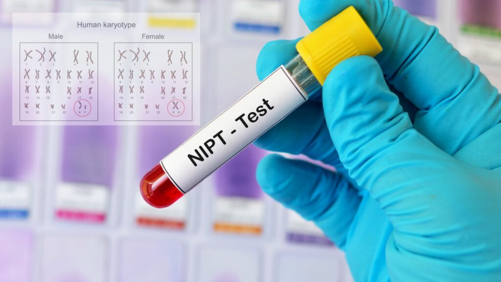 NIPT test in Ghaziabad